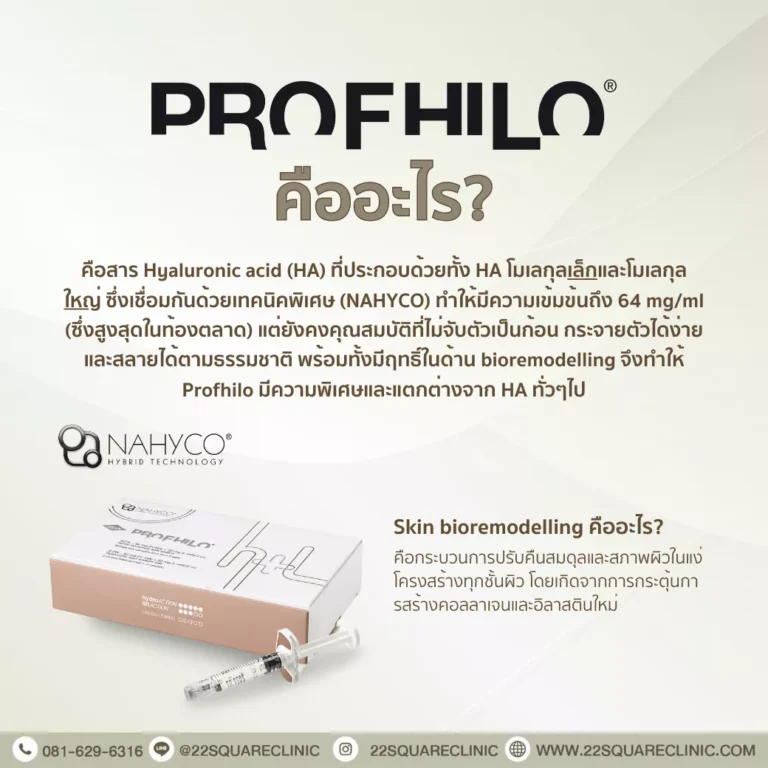 Profhilo คืออะไร?
