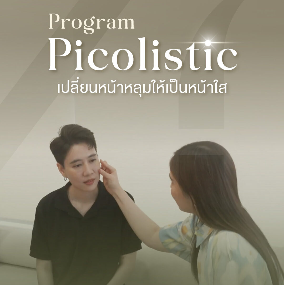 ภาพปกรีวิวรักษาหลุมสิวด้วยโปรแกรม Picolistic โดยใช้ Picosecond Laser | 22 Square Clinic