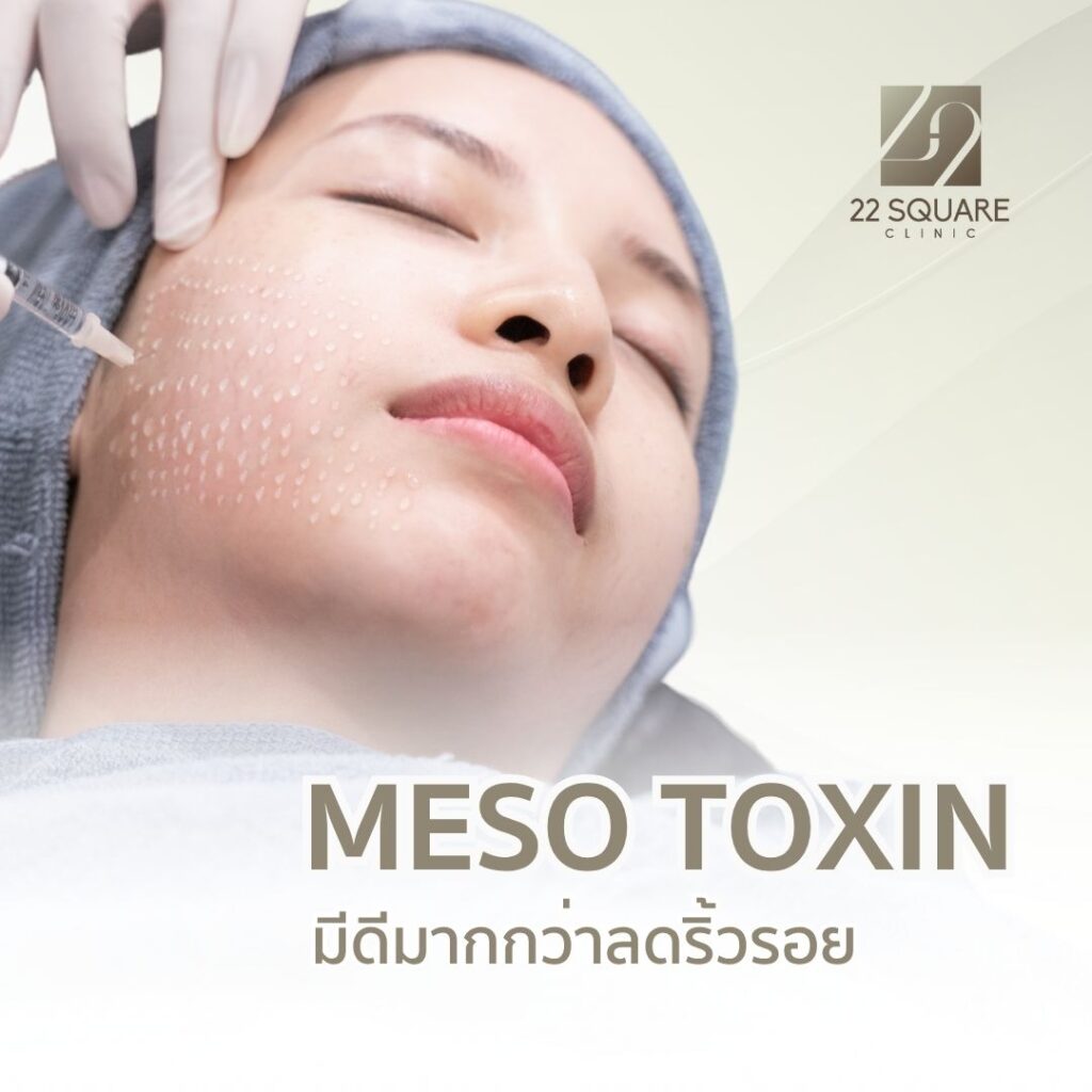 เทคนิค Meso Toxin หรือ Baby Botox โดยแพทย์เฉพาะทาง | 22 Square Clinic
