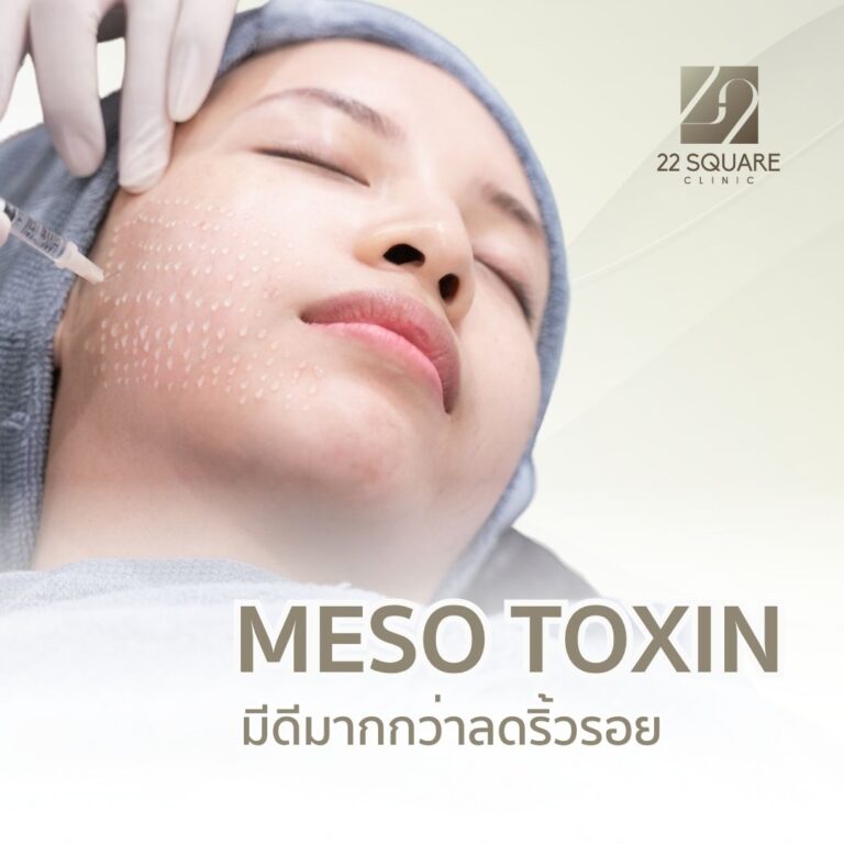 เทคนิค Meso Toxin หรือ Baby Botox โดยแพทย์เฉพาะทาง | 22 Square Clinic