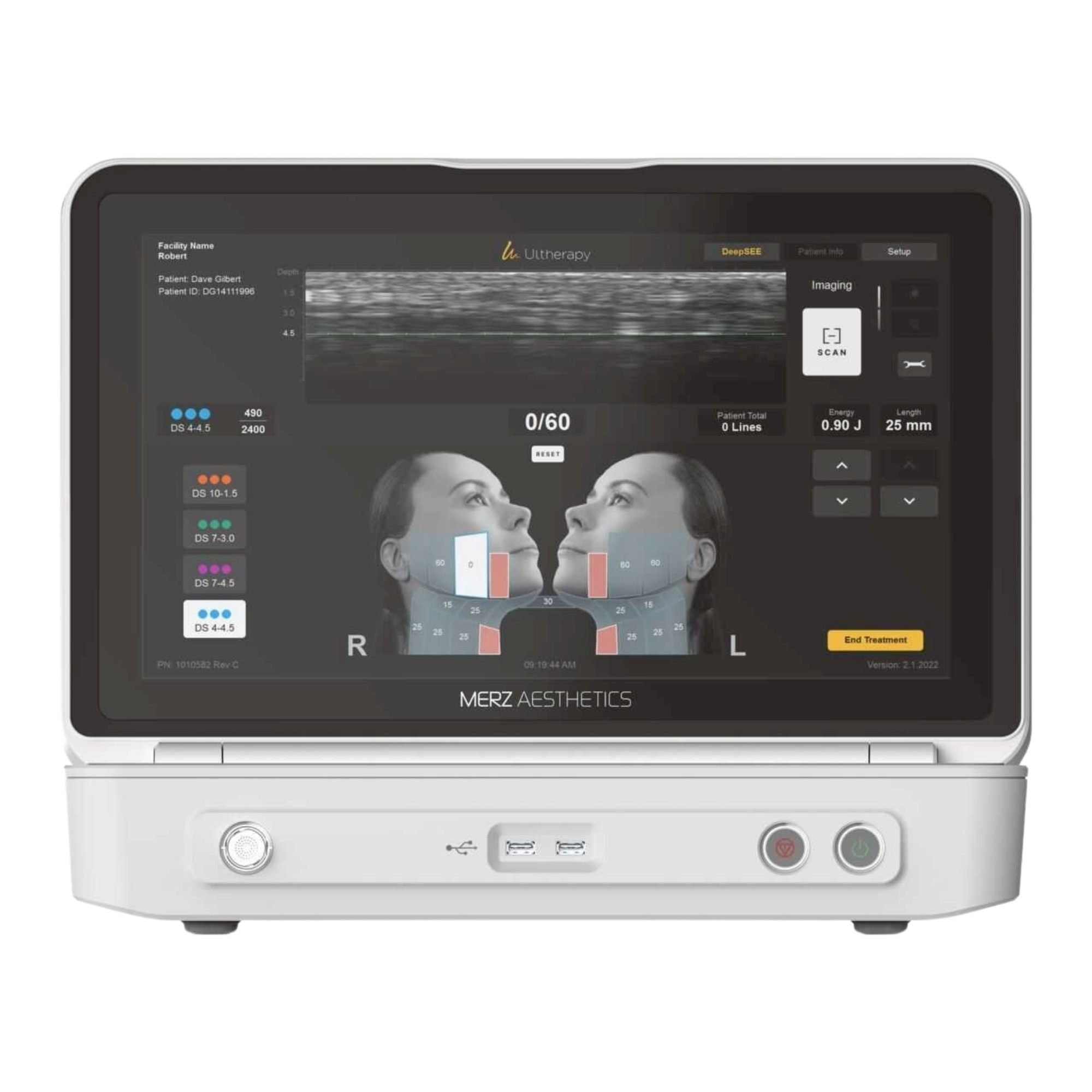 เครื่อง Ulthera Prime 3
