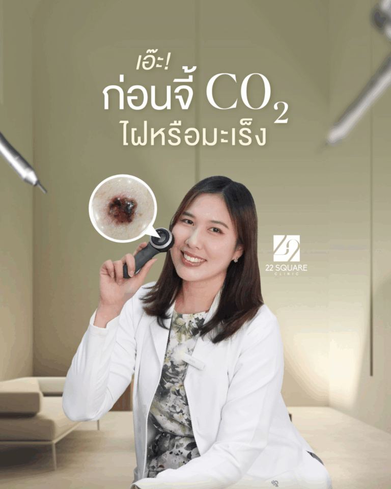 รีวิวสำหรับลงเวบ