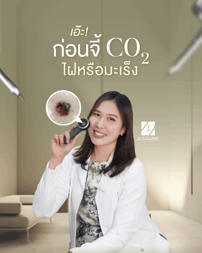รีวิวสำหรับลงเวบ