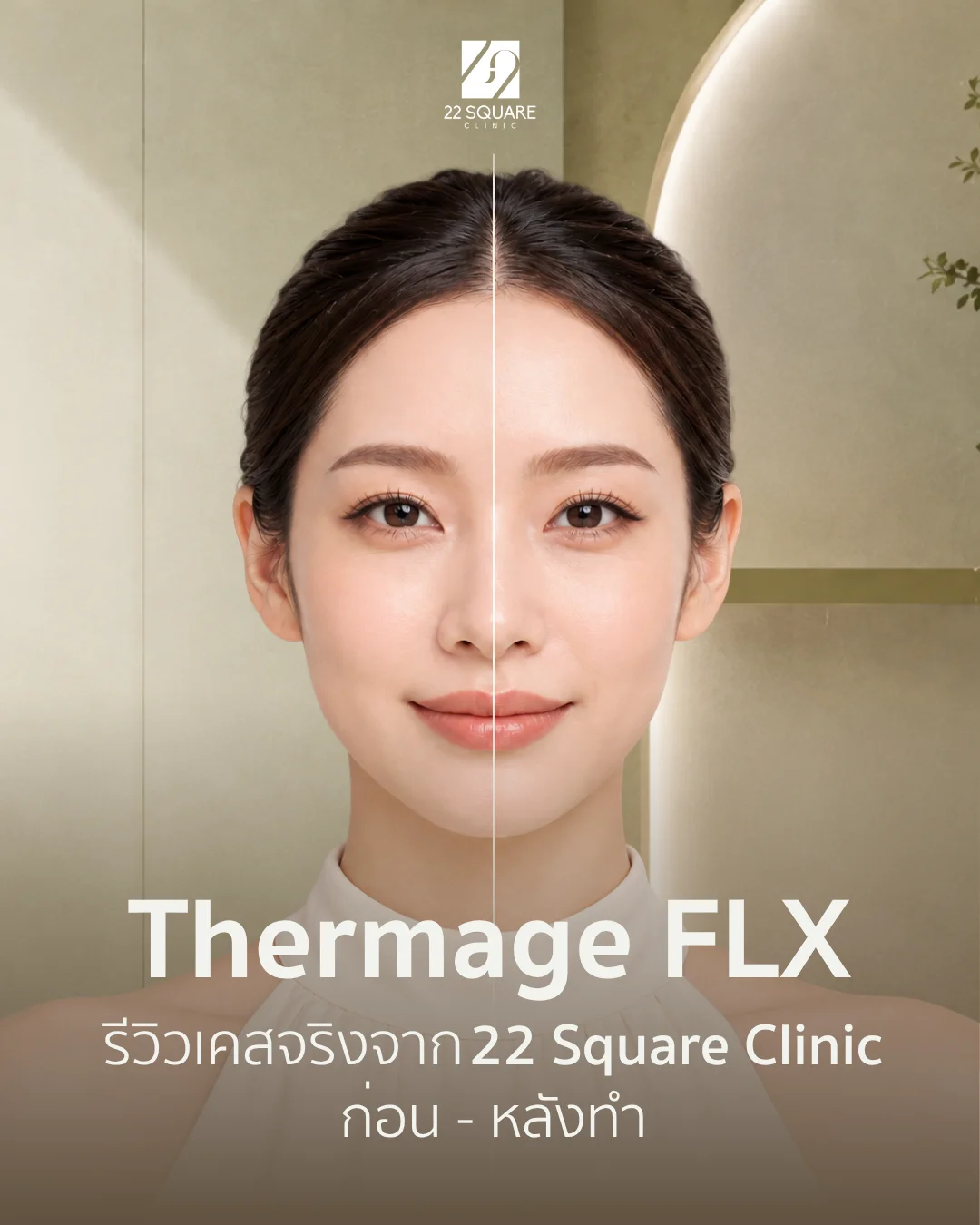 รีวิวโปรแกรม Thermage FLX